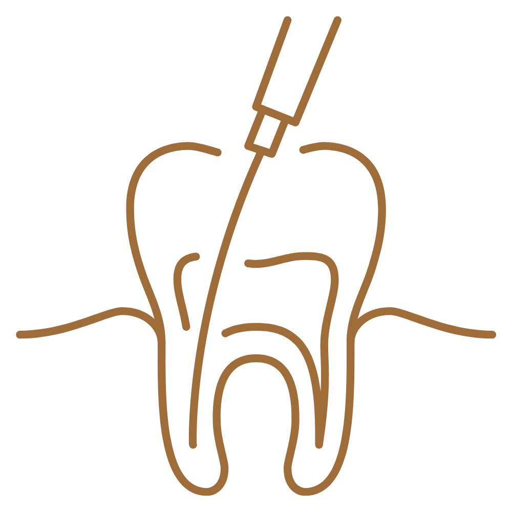 Root Canal Treatment