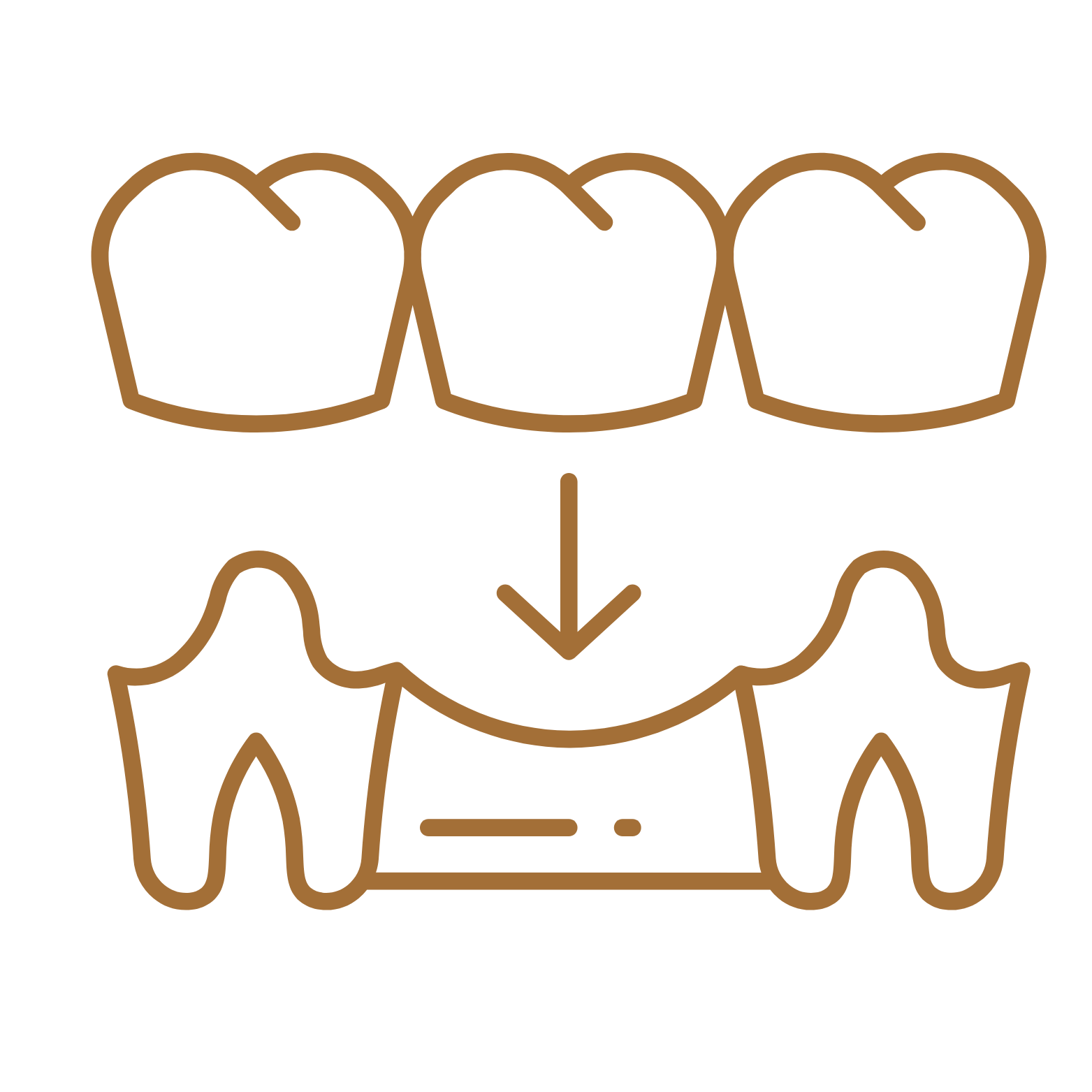 Crowns & Bridges